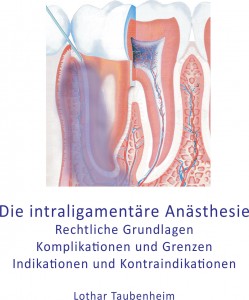 Die intraligamentäre Anästhesie