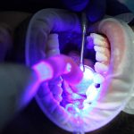 Zahnarzt-Behandlung