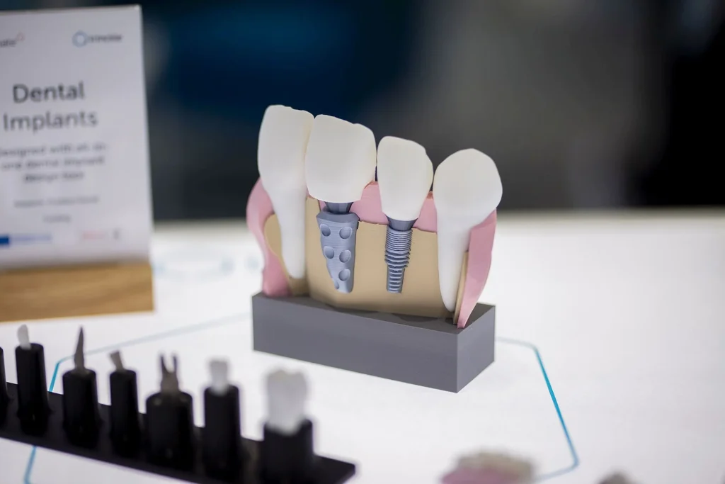 Zahnimplantat_Foto_trinckle_3D_GmbH